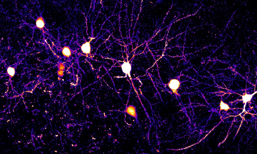 neurons
