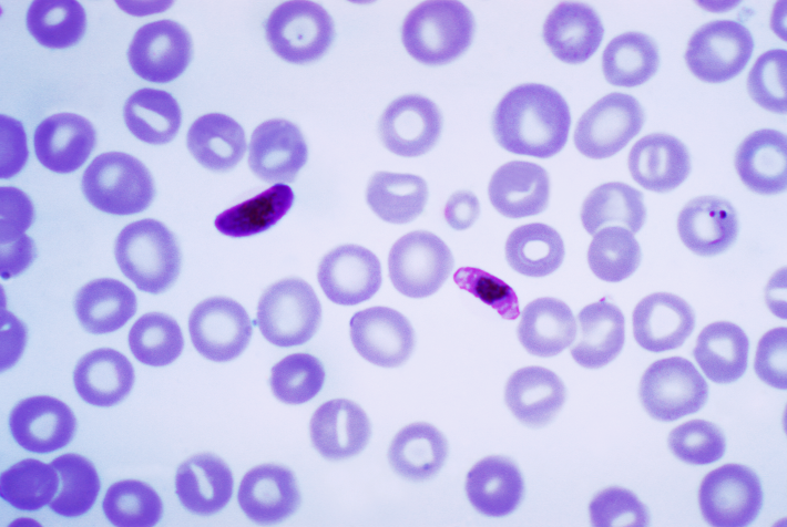 Plasmodium
