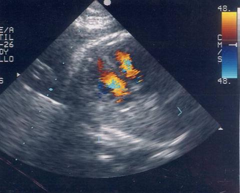 Echocardiography