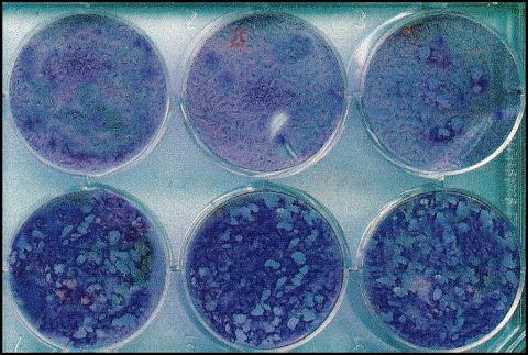 Varicella-zostervirus