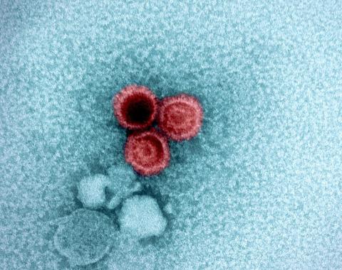 Epstein-Barr virus