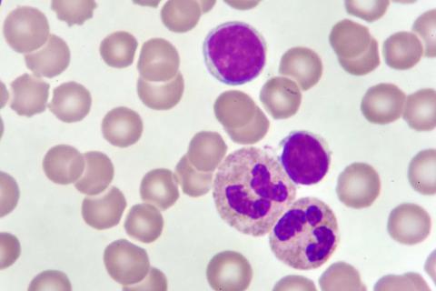 Leucemia