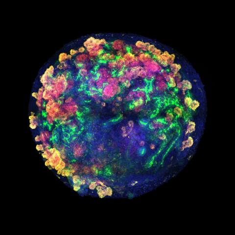 Organoid