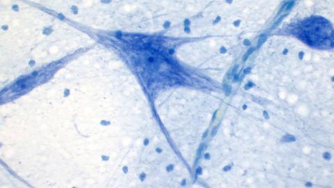 motor neuron