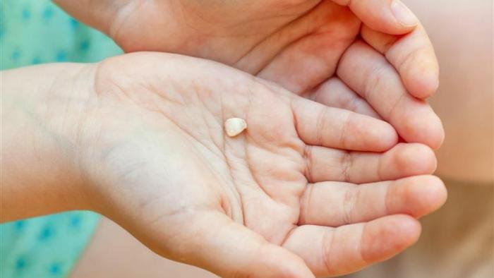 baby tooth